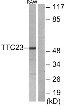 TTC23 rabbit pAb Antibody