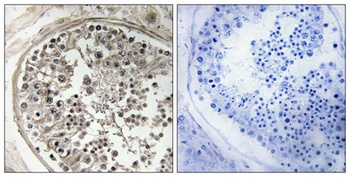 MRP-S5 antibody