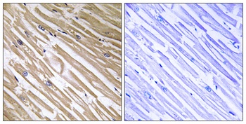 NDRG4 antibody