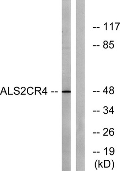 ALS2CR4 rabbit pAb Antibody