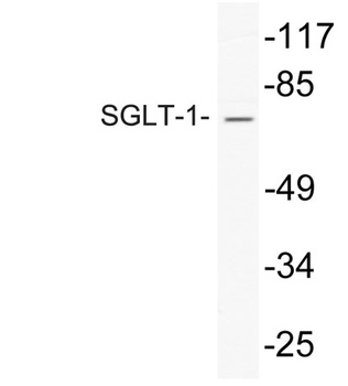 SGLT-1 rabbit pAb