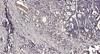 SGLT-1 rabbit pAb Antibody