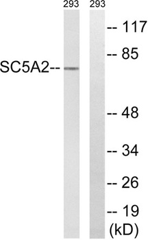 SGLT-2 antibody