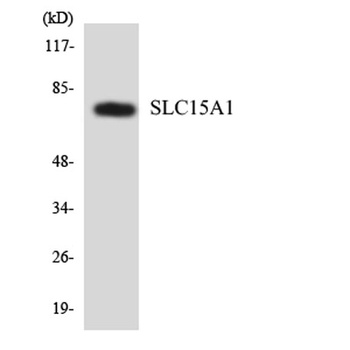 PEPT1 rabbit pAb Antibody