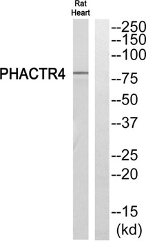 PHACTR4 rabbit pAb Antibody