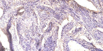PHACTR4 rabbit pAb Antibody
