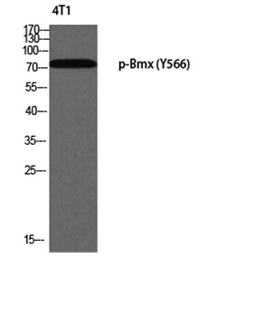 Bmx (phospho-Tyr566) antibody