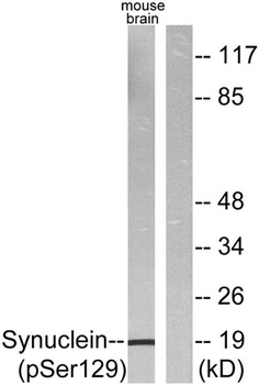 Synuclein-alpha (phospho-Ser129) antibody