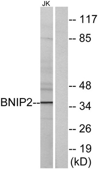 BNIP-2 antibody