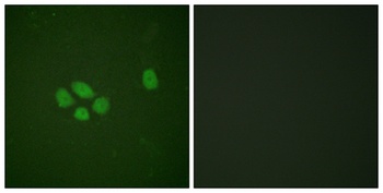 Sox-9 (phospho Ser181) rabbit pAb Antibody