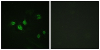 Sp1 (phospho-Thr453) antibody