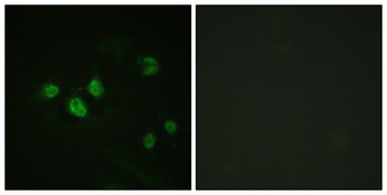 Sp1 (phospho Thr453) rabbit pAb
