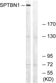 Spectrin β II rabbit pAb