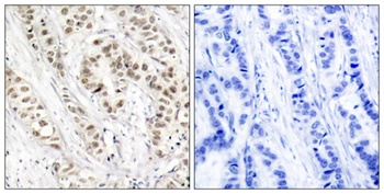 BRCA1 (phospho-Ser1524) antibody