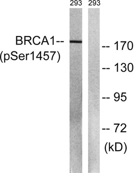 BRCA1 (phospho-Ser1457) antibody