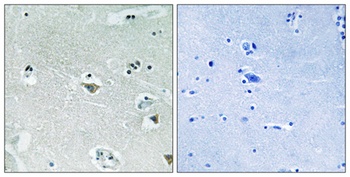 SREBP-1 (phospho Ser439) rabbit pAb
