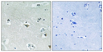 SREBP-1 (phospho-Ser439) antibody