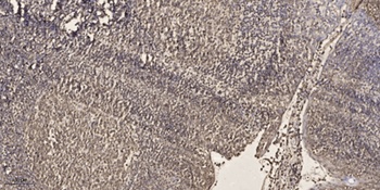 SRF (phospho-Thr159) antibody