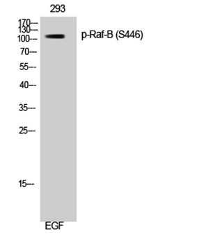 Raf-B (phospho-Ser446) antibody