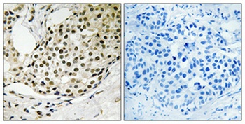 SSB (phospho-Ser366) antibody