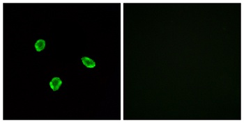 SSTR1 rabbit pAb Antibody