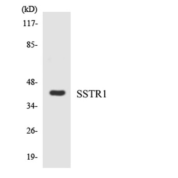 SSTR1 antibody