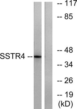SSTR4 antibody