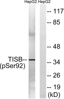 TIS11B (phospho-Ser92) antibody
