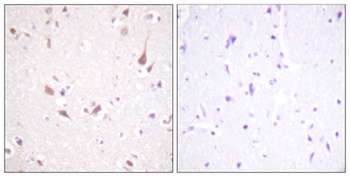 Krs-1/2 antibody