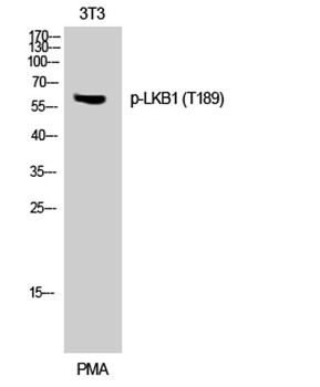 LKB1 (phospho-Thr189) antibody