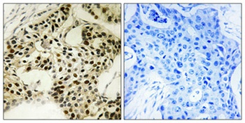 LKB1 (phospho Ser334) rabbit pAb