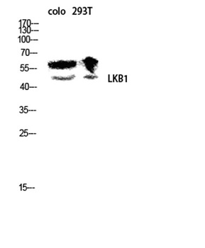 LKB1 rabbit pAb Antibody