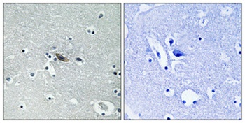 Syntaxin 1 (phospho Ser14) rabbit pAb