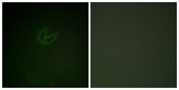 Syk (phospho Tyr323) rabbit pAb