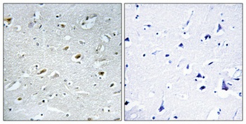 TACC1 rabbit pAb