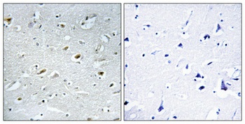 TACC1 antibody