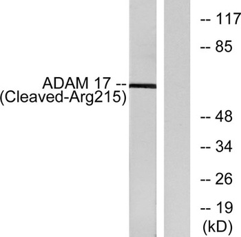 Cleaved-TACE (R215) antibody