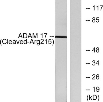 Cleaved-TACE (R215) rabbit pAb