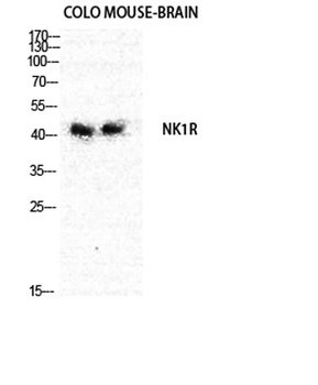 NK-1R antibody