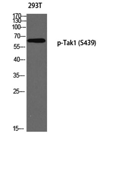 Tak1 (phospho-Ser439) antibody