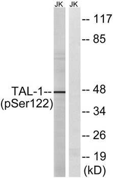TAL1 (phospho-Ser122) antibody