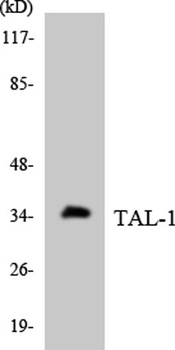 TAL1 rabbit pAb