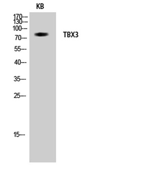 TBX3 antibody