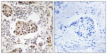 Tctex5 antibody