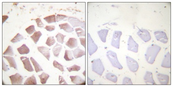 Actin-α/γ (phospho Tyr55/53) rabbit pAb