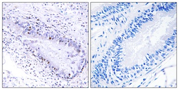 TP1 antibody