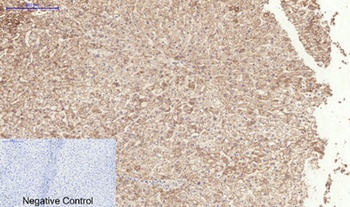 TGFβ RI (phospho Ser165) rabbit pAb