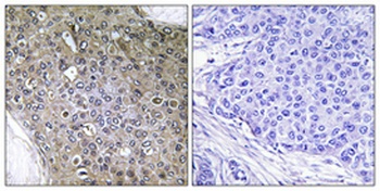 TGFβ RIII (phospho Thr842) rabbit pAb