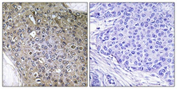 TGF beta RIII (phospho-Thr842) antibody