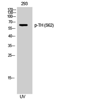 TH (phospho-Ser62) antibody